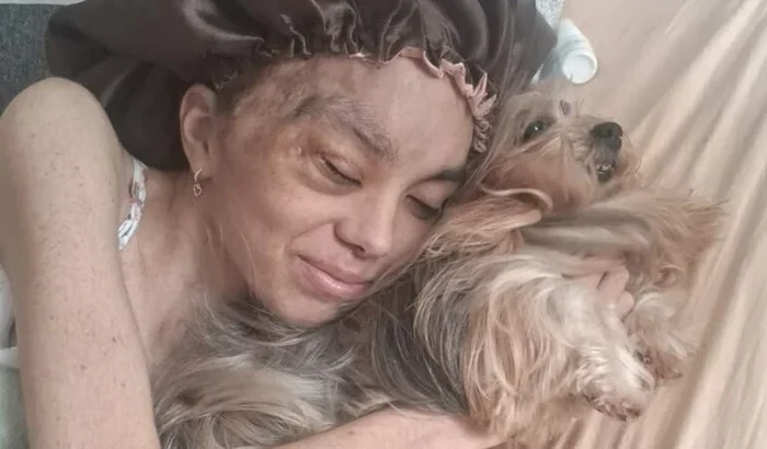 Ajude Marina a ter uma nova perna mecânica